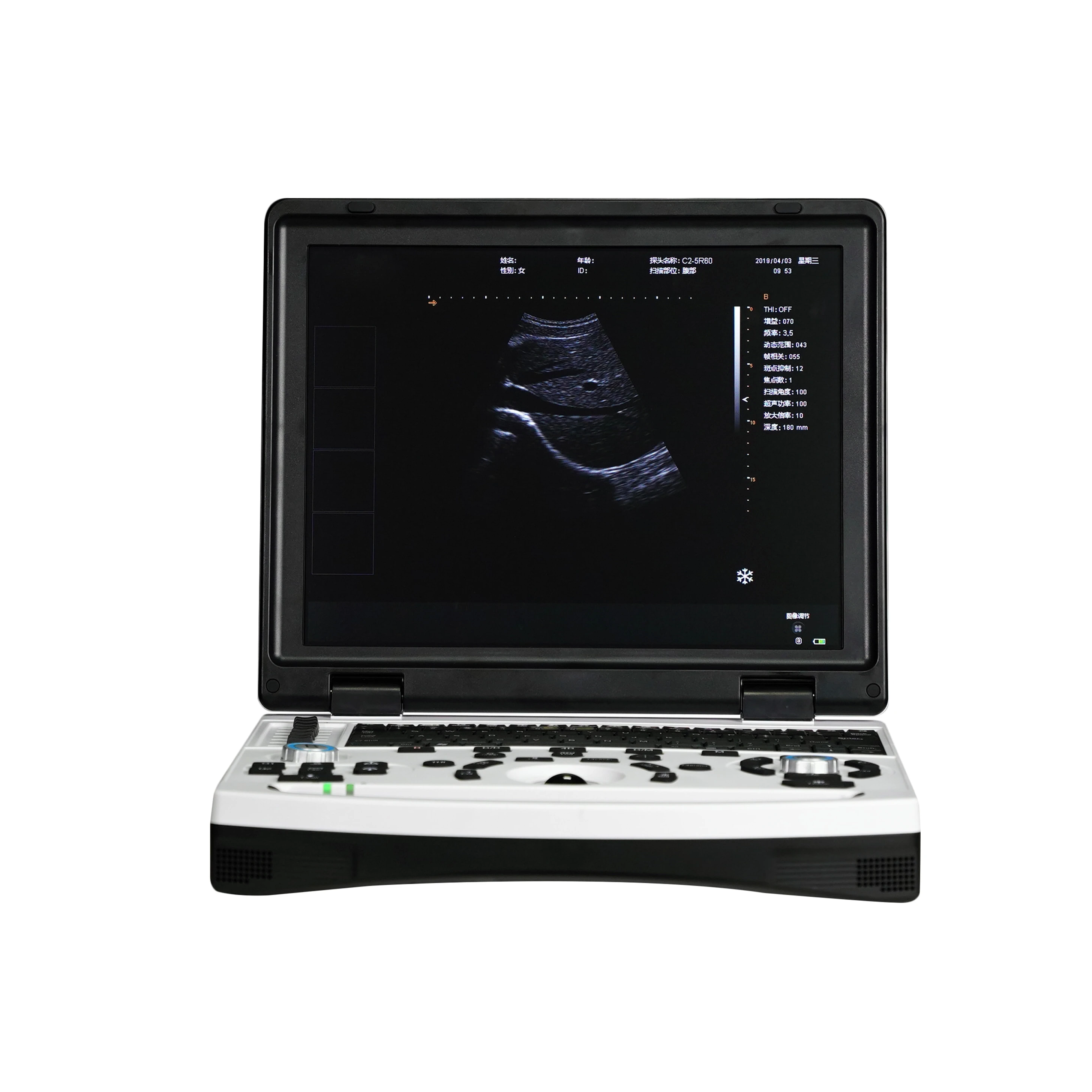 

Multifunction Ultrasonido Notebook Full Digital Ultrasound Diagnostic Instrument