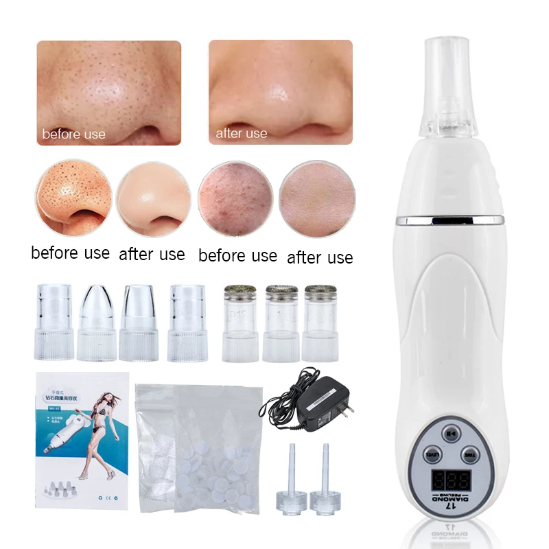 Handheld Diamant Mikrodermabrasion 3-stufige Maschine Mitesser Akne Entfernung Gesichts Hautpflege Peeling Reinigung Falten Pflege Werkzeug