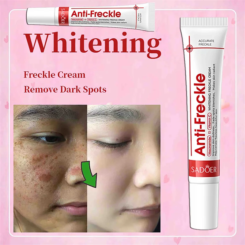 

Whitening Freckle Cream Remove Dark Spots Anti Freckle Face Creams Niacinamide Fade Pigmentation Melasma Brighten Skin Care 20g