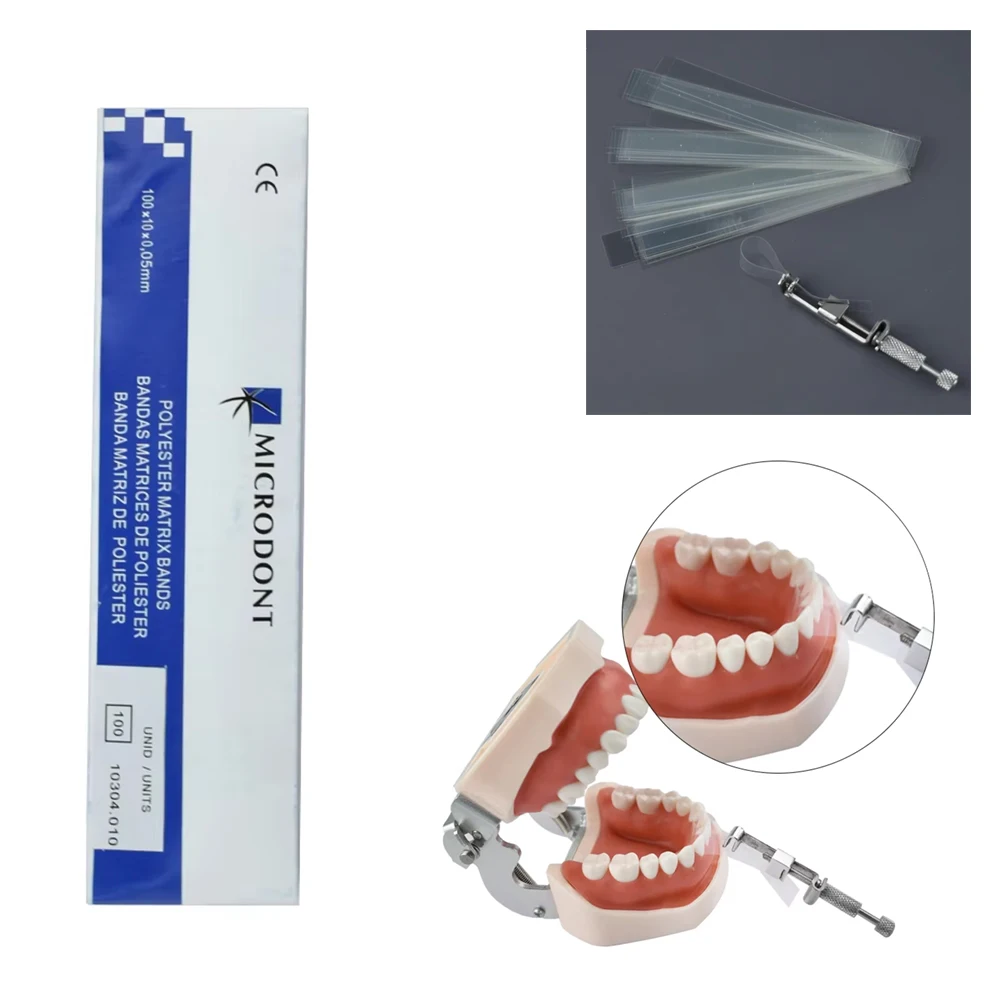 

Dental Polyester Matrix Bands 100Pcs Orthodontic Teeth Separation Bands No Retainer Needed Dental Lab Consumables