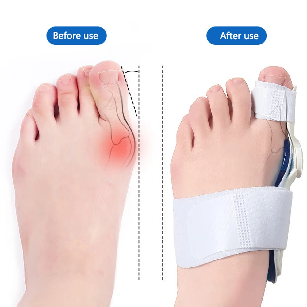 Orthopedic Bunion Toe Straightener for Women Men Adjustable Bunion Splint Toe Stretcher for Big Toe Bunion Relief