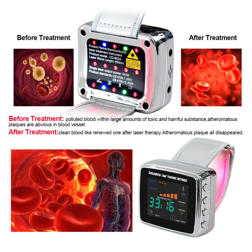 New LLLT 15 Holes Irradiation 650nm Red Light Wrist Apparatus Diabetic Hypertension Rhinitis Relief Varicose Veins Blood Clean