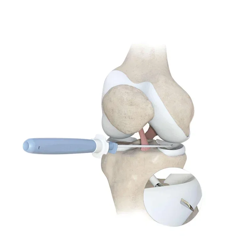 Meniscal Repair System Truespan Meniscal Repair Suture Meniscus Knee Surgery needl