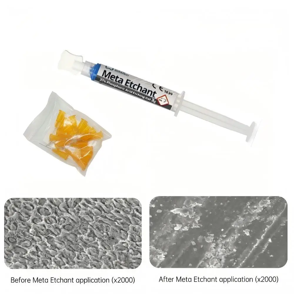 

Мета-дентальный эантант для композитной реставрации, предварительная обработка дентина, 37% фосфорно-кислотный гель для кондиционирования эмалевой поверхности, 3 шт.