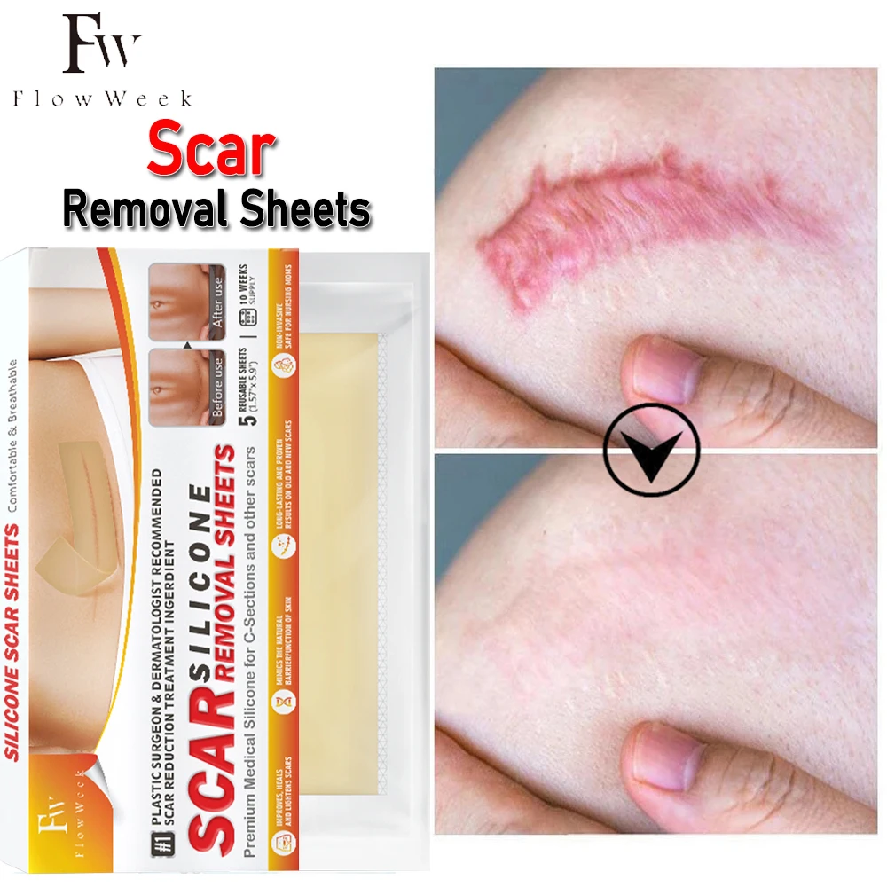 Flow Week Scar Silicone Strips Professional Scar Removal Sheets Effective Scar Removal Strips for C-Section Keloid Surgery Burn