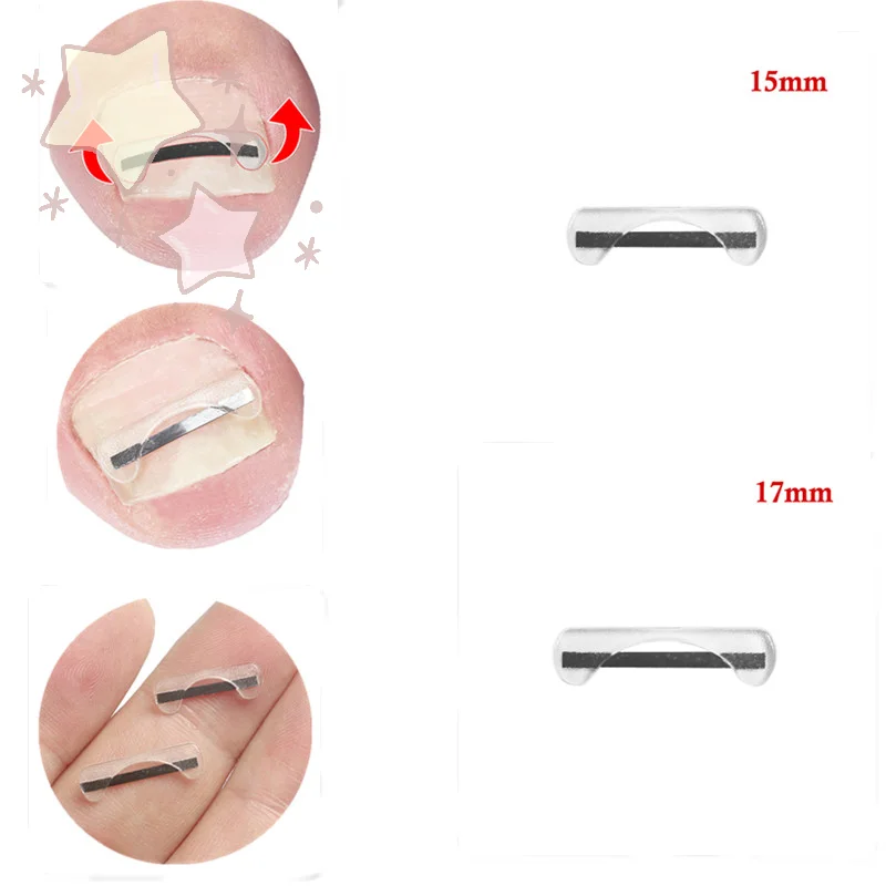 سلك تصحيح أظافر القدم من سبائك التيتانيوم لعلاج الأظافر نام مع ملصقات أداة السيليكون ملحقات العناية بالقدم