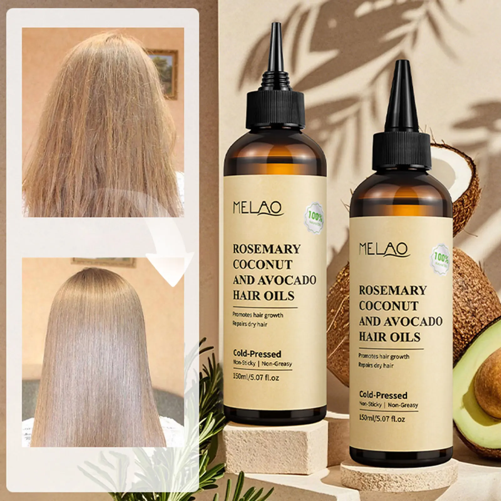 

150ml Rosemary Coconuts Avocado Hair Oils Hair Loss Treatments Hair Growth Repair Serum For Hair Care