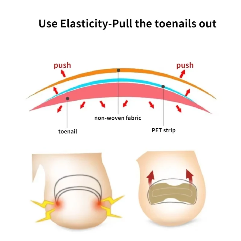 ملصقات تصحيح الأظافر نام أظافر مصحح بقع علاج الداحس استعادة أدوات مصحح باديكير