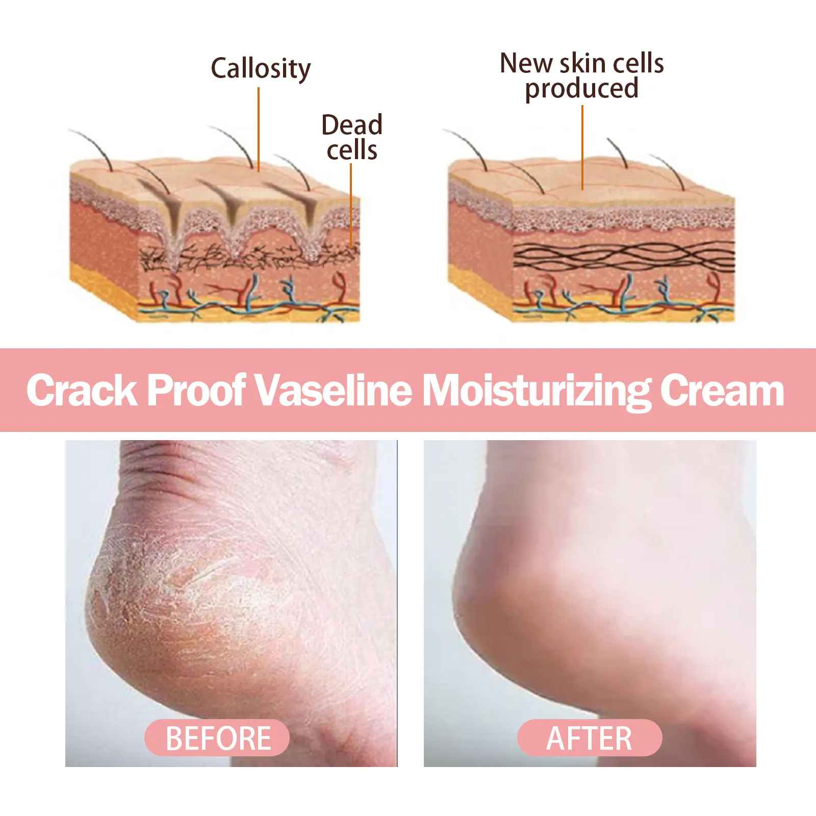 Multi Purpose Heel Balm Stick,Mess Free&On the Go,Cracked Heel&Rough Skin Repair,Instant Hydration&Antioxidant Protection,Intense Moisture&Anti Cracking,Refreshing Watermelon Soothing&Fast Absorbing Formula,Vegan
