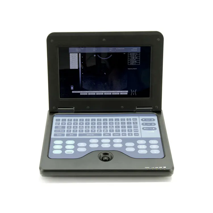 

CONTEC CMS600P2 diagnostic scanner medical diagnostic equipment