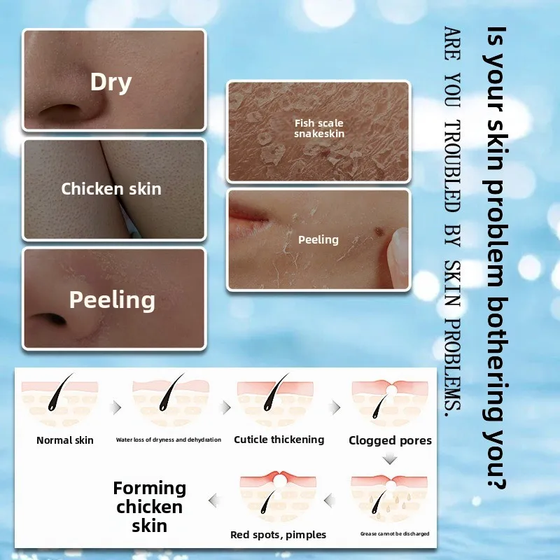 كريم الوجه بالكيراتوسيس بيلاريس - ينعم لامع بشرة الدجاج والمسام المسدودة، مكثف نسيج البشرة للنساء والمراهقين #2