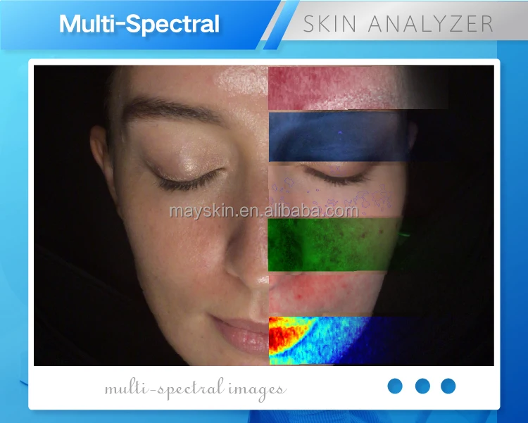 High End Meicet 3D Advanced AI Facial Skin Scanner Skin Analysis Device For Beauty Center/ Beauty Spa / Clinic