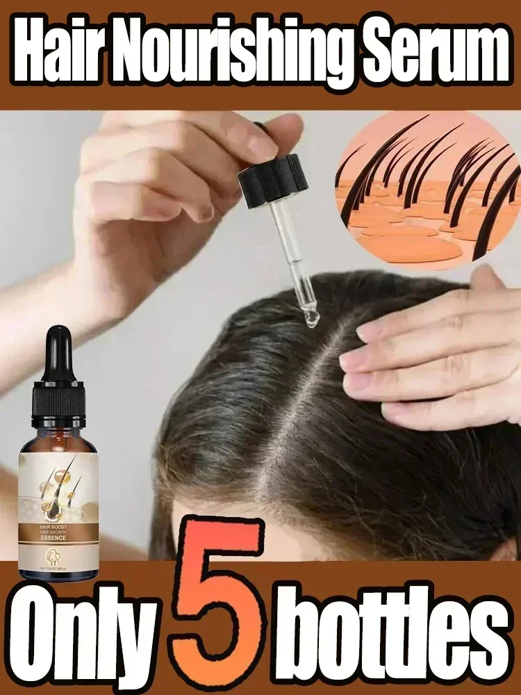 Fast Hair Growth Essential oil Promoter Hair Loss Hereditary Seborrheic Alopecia Treatment For Hair Growth Essence Natural