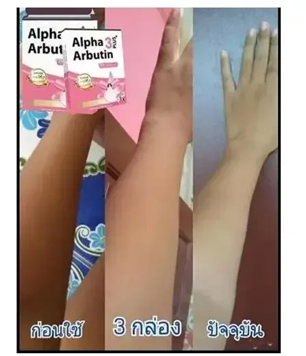 Alpha Arbutin 3 Plus Powder Mix With Lotion Skin Lightening Whitening Cream Brighten ลดฝ้าผิวคล้ํา