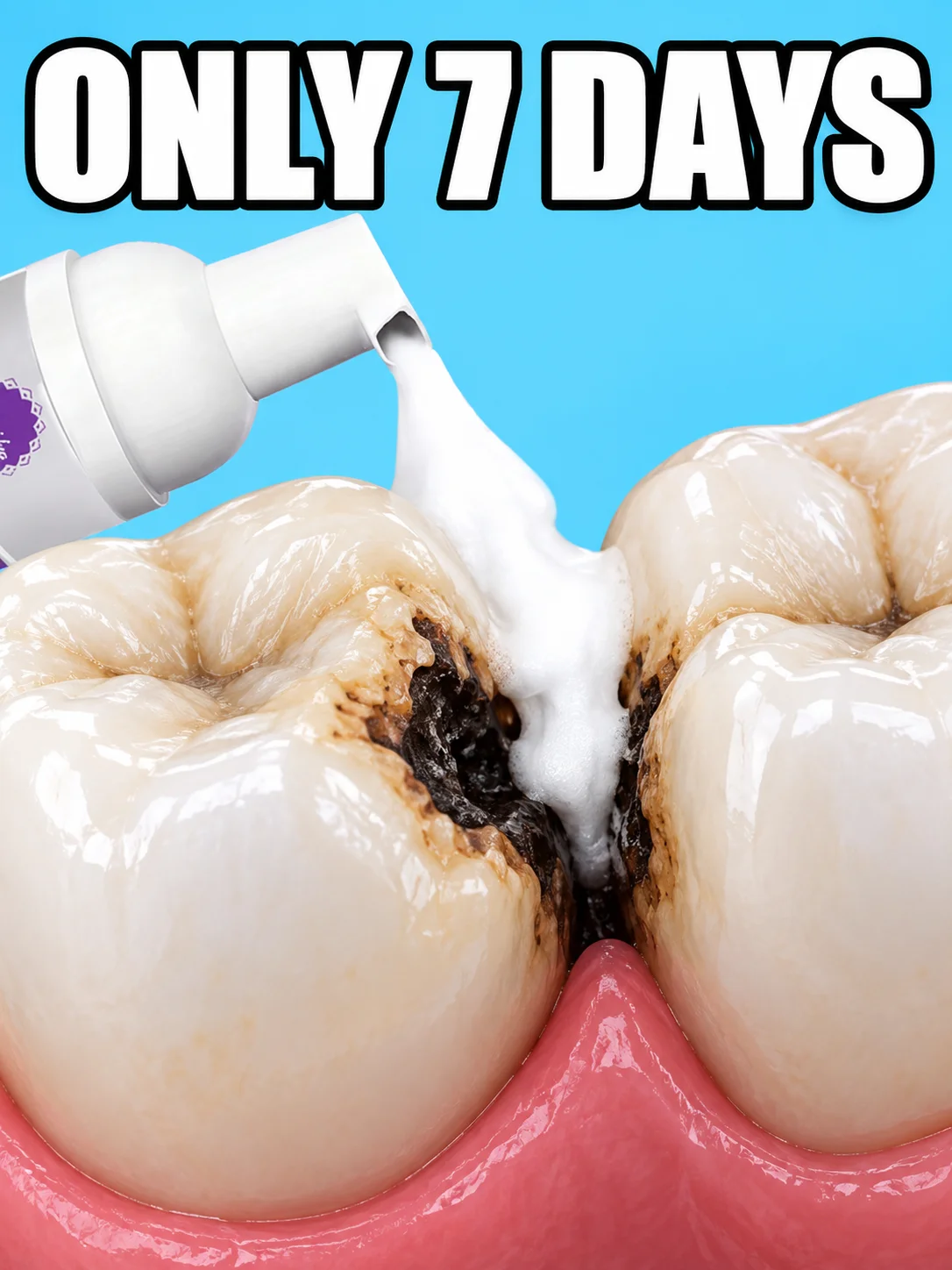 2026 Gen-3, Stop Cavities Early Help People with Yellow Stains or Black Spots On Their Teeth Regain a Confident Smile.