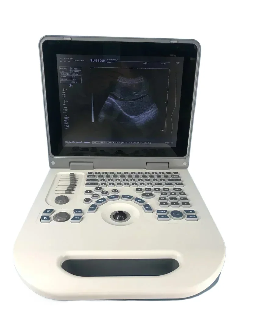 SUN-806G Ultrasound BW Portable Full Digital Portable laptop Ultrasound Instrument BPD,GS,CRL,FL,HC,OFD,TTD,AC 8 measurement