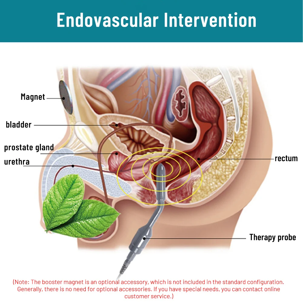 Prostate Treatment Instrument Magnet Heating Prostate Therapy Inflammation Rehabilitation Physiotherapy Stimulator Anal Massage