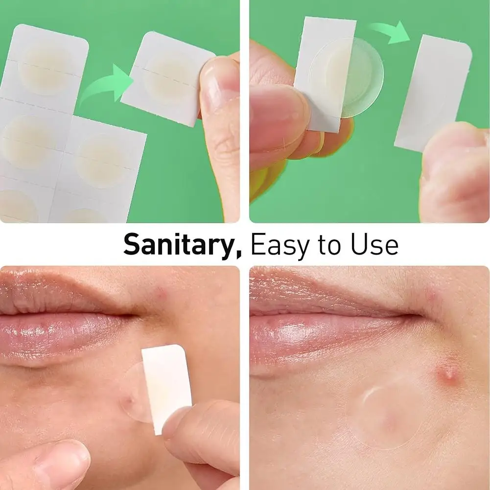 الغروانية المائية حب الشباب التصحيح غير مرئية حمض الهيالورونيك جولة حب الشباب التصحيح العيب غطاء بقعة العلاج ملصقات الوجه العناية بالبشرة