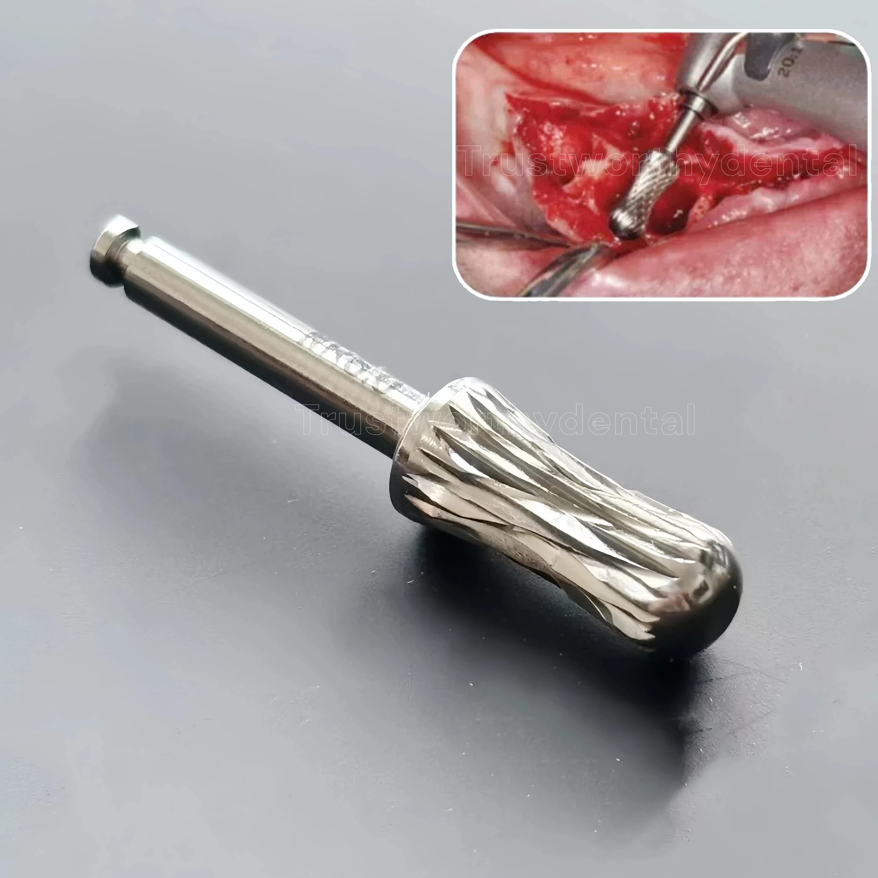 

Dental Ridge Contouring Bur Crest Remover Ridge Reduction Drill Trimming Shape Sculpte Hourglass Bone Mill Drill