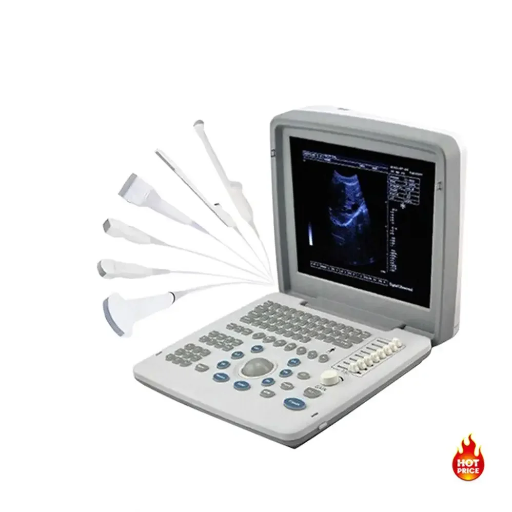 

Portable Full Digital Diagnostic Ultrasound Scanner Handheld Ultrasound Landscape