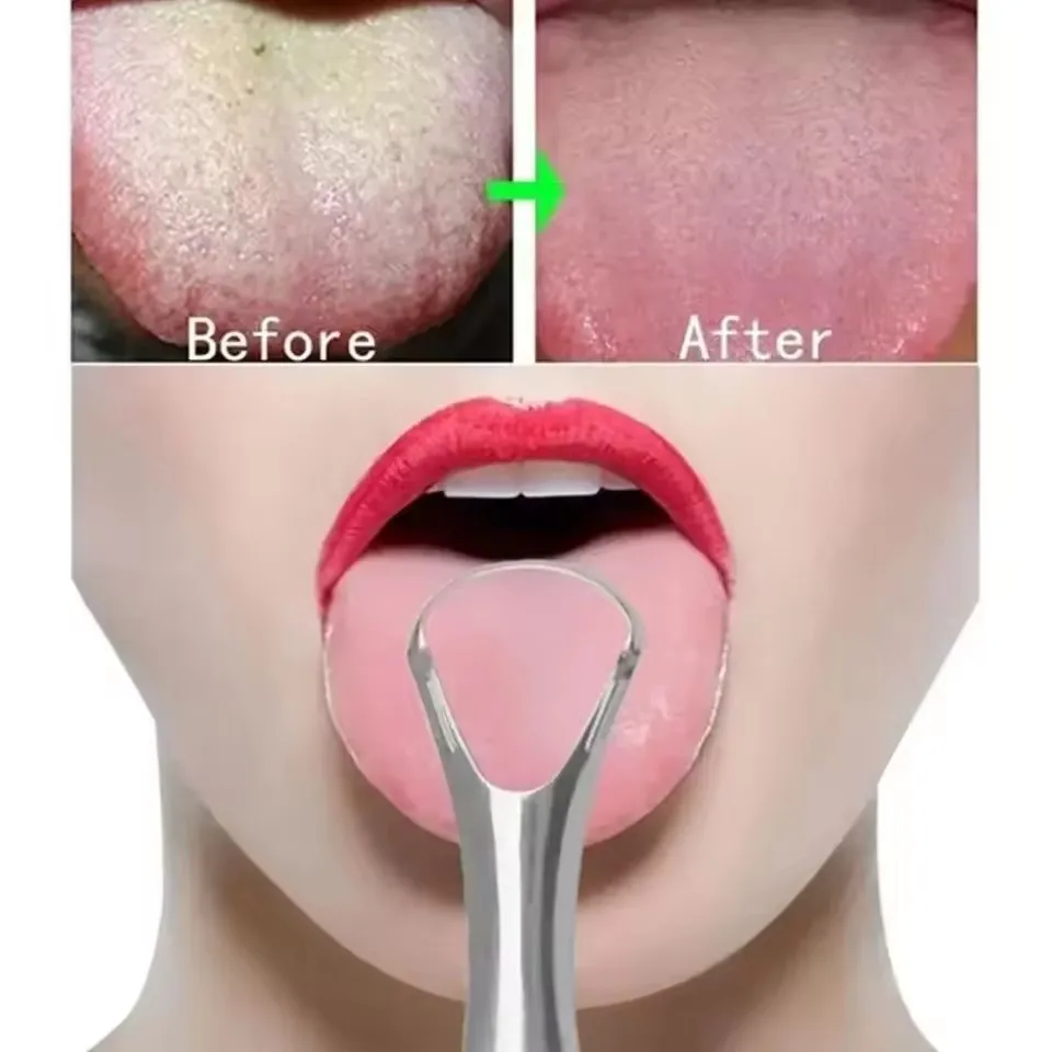 Clean Tongue Scraper Tongue Remover Halitosis Tongue Coating Oral Care Tongue Scraping Brush Stainless Steel Oral Cleaner Tools