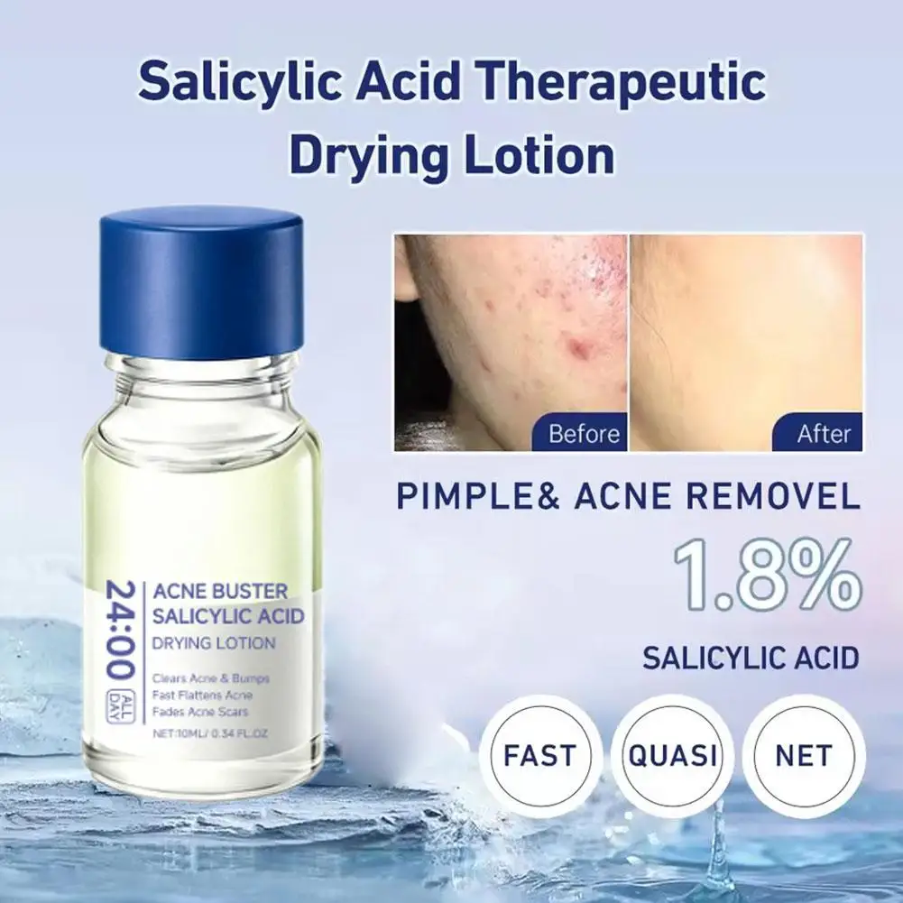 Salicylic Acid Drying Lotion Face Serum with Cotton Swab– Reduce Pimples & Breakouts Fade Acne Scars Minimize Pores Skin Renewal