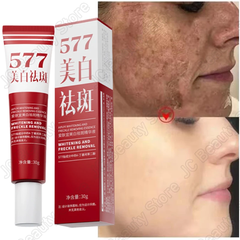 Whitening Freckle Serum Fade Pigmentation Moisturizing Brightening Improve Dull Anti Aging Remove Dark Spots Face Care Essence