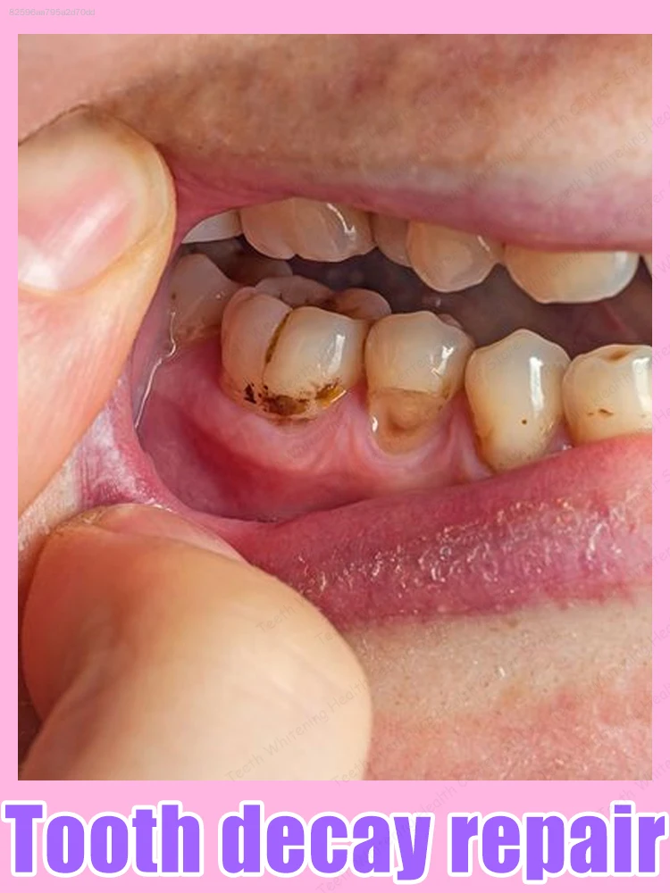 Зубная паста от кариеса，Keep your teeth clean and you'll have a confident smile.