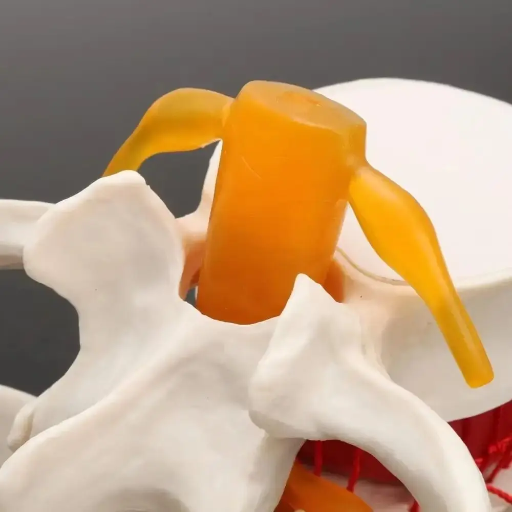 3D Model Lumbar Model 1.5X Enlarge Compression Demonstration Human Anatomy Skeleton Model Simulation Spinal Pressure Lesions