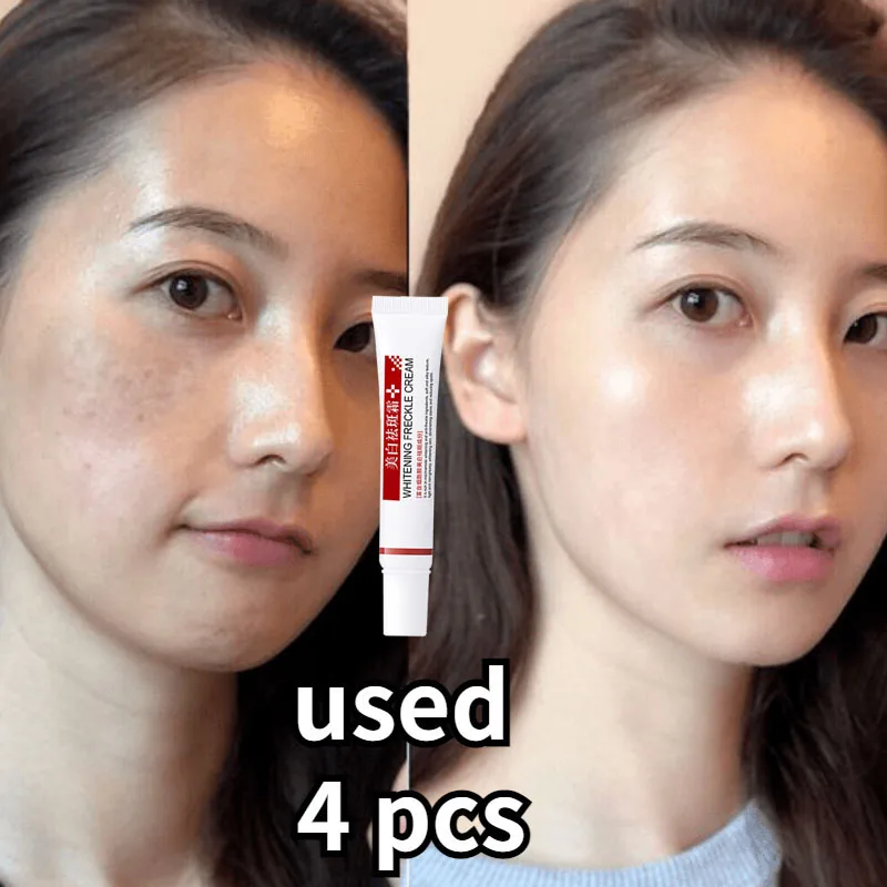 Women Fade Melasma Cream Lightening Dull Brightening Emulsion Reduce Melanin Brighten Cream For Dark Skin Face Moisturiz Product