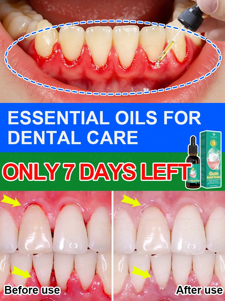 

Rᴇᴘᴀɪʀ ᴅᴀᴍᴀɢᴇᴅ ɢᴜᴍs, ʀᴇʟɪᴇᴠᴇ ɢᴜᴍ ᴘᴀɪɴ, sᴛʀᴇɴɢᴛʜᴇɴ ɢᴜᴍs, ʀᴇsᴛᴏʀᴇ ʜᴇᴀʟᴛʜʏ