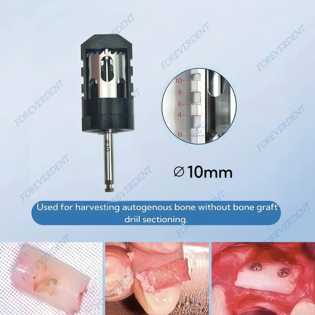 10mm Dental Semilunar Bone Collector Drill GBR SLT Semilunar Technique Semilunar Shell Bone Argumentation Bone Colloector