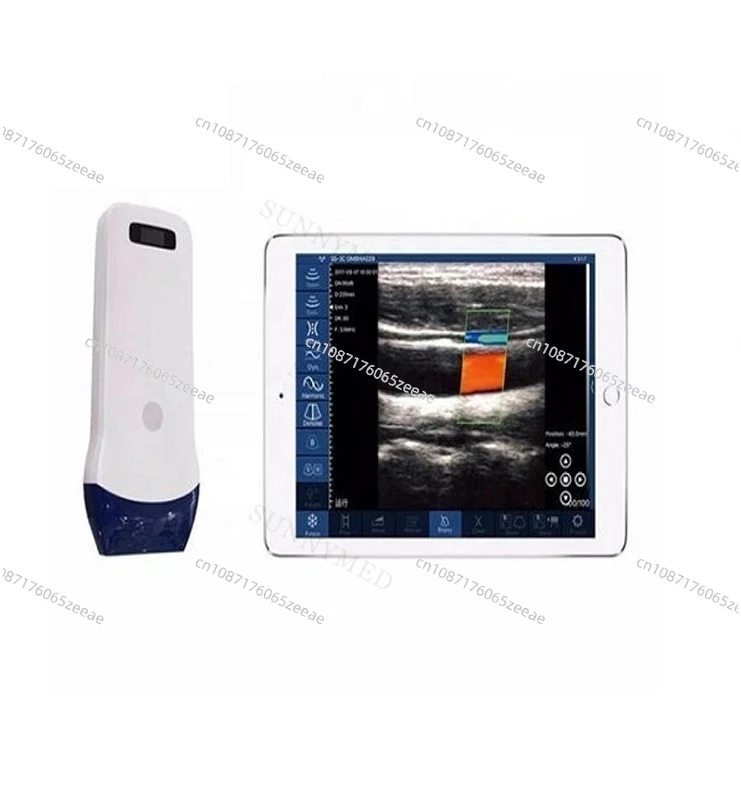 SY-5L Portable Medical Color Doppler Probe Pocket Wireless Wi-Fi Ultrasound Machine wireless ultrasound scanner