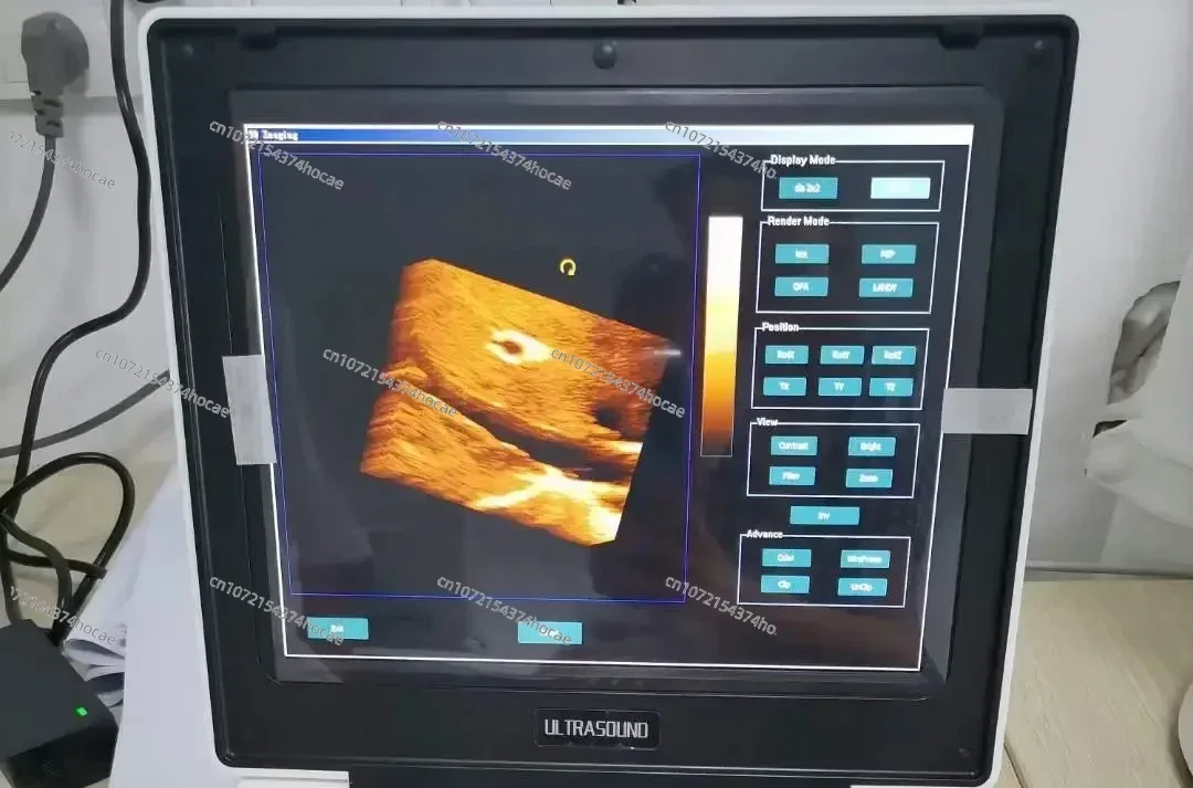 

3D Color Doppler Small Big Animal Veterinary Pet Notebook Ultrasound Diagnostic Echo Machine