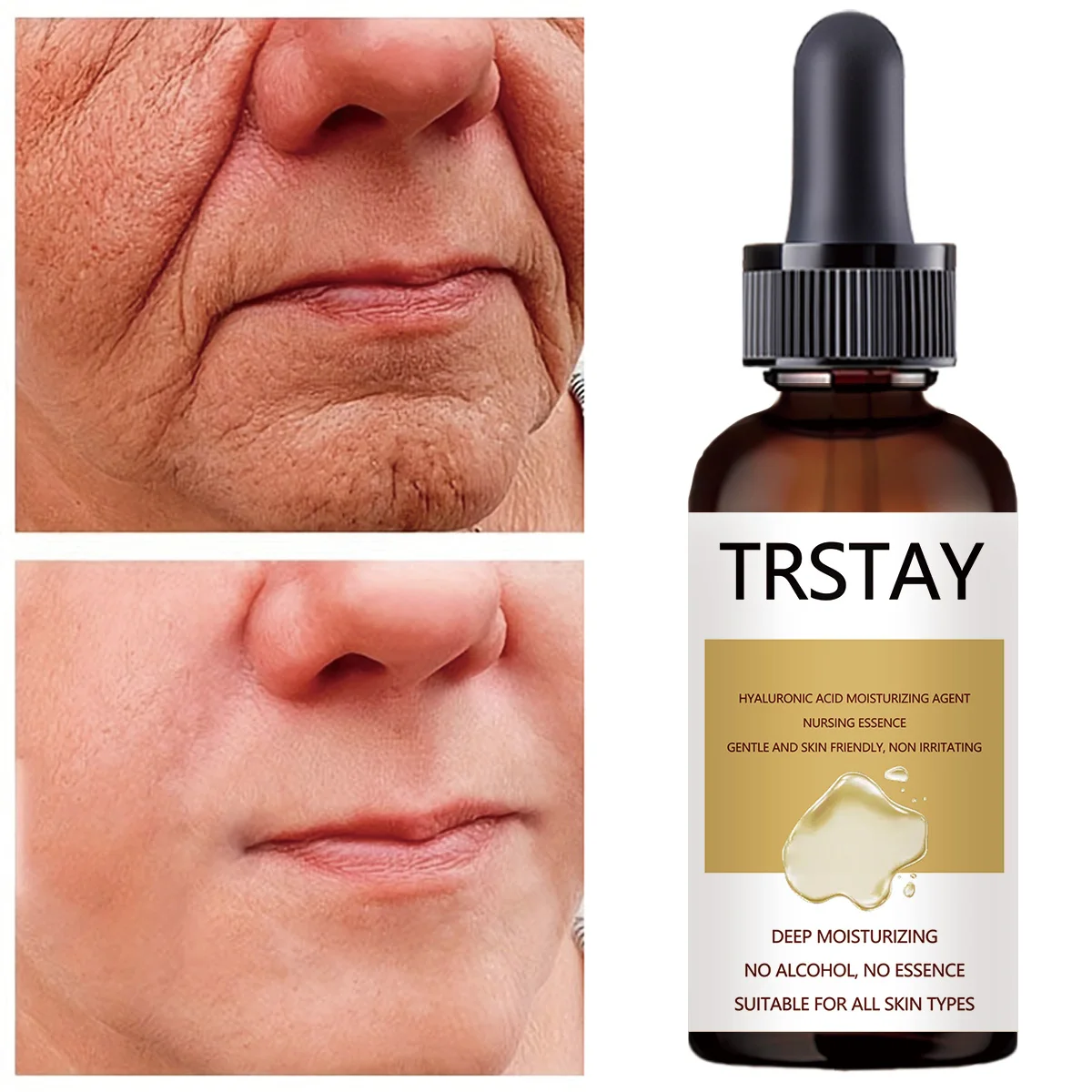 

Ginger Hair Growth Dropper bottle Serum For Anti Hair Loss Essential Oil Products Prevent Hair Thinning Dry