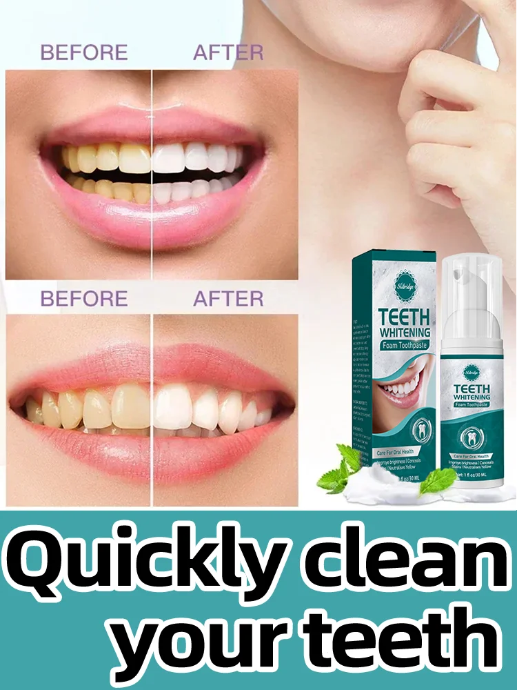 

Teeth whitening Tooth Cleaning Tartar Removal Toothpaste Mousse