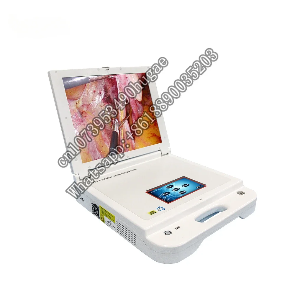 digital Endoscope hd vagina portable and  kidney stones