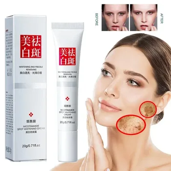 Vervaagt Sproet Donkere Vlekken Gezichtscrème Niacinamide Whitening Cream Vitamine E Verbeteren Dofheid Snel Fleuren Voeden Huidverzorging