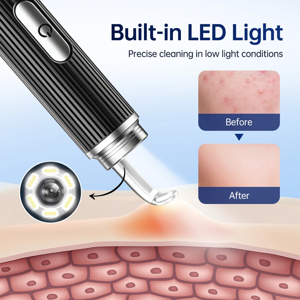 Visuele Comedondrukker Camera 50X Vergroten Elektrische Acne Cleaner Camera Gezicht Huidverzorging Poriën Cleanser Whiteheads Extractor Tool
