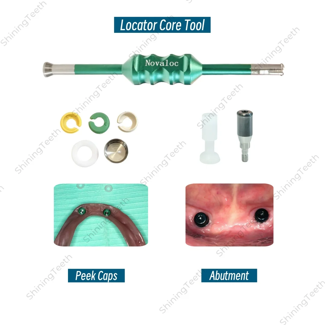 

Retention Caps Locator Mounting Tool Novaloc Type Peek Cap ITI ADLC Abutment