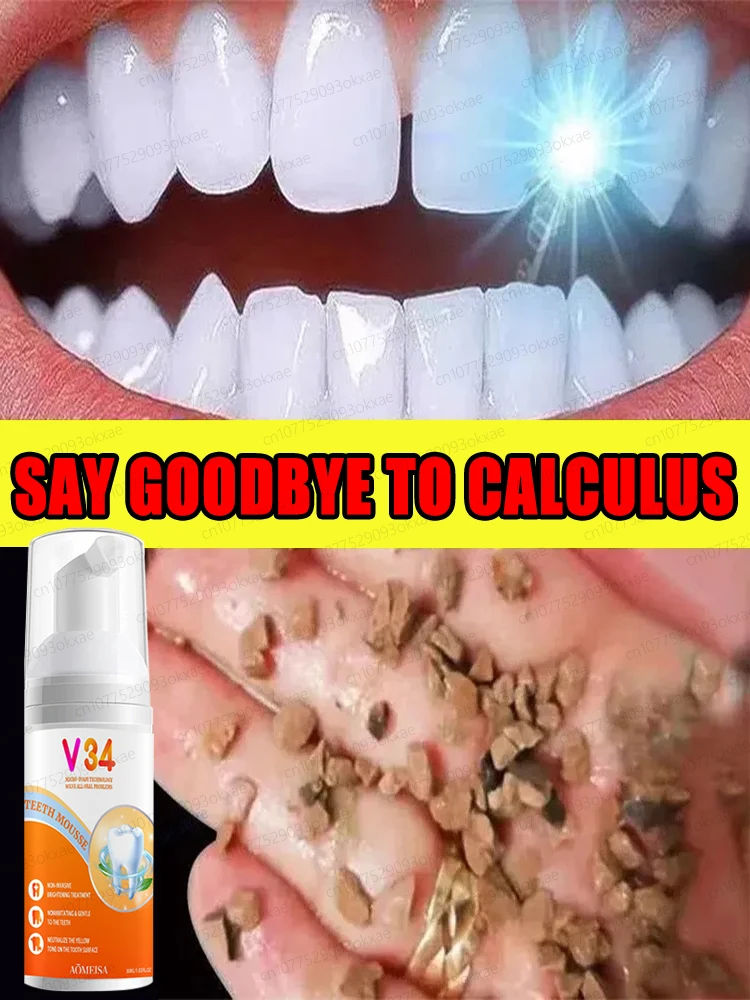 Teeth Cleaning Mousse, removes tartar, yellow teeth, bad breath and periodontitis. fresh breath