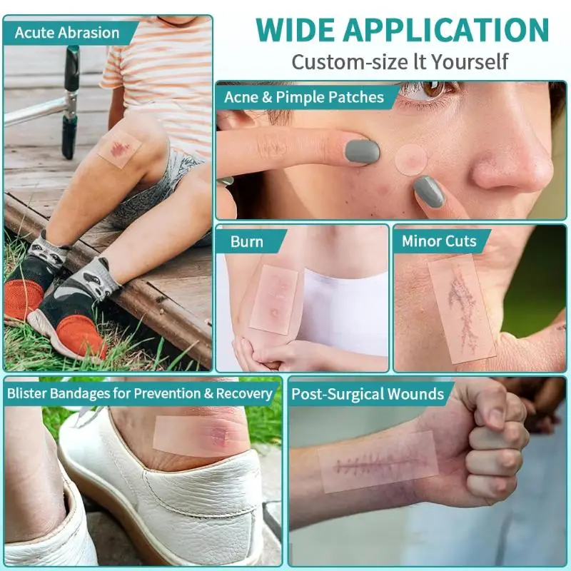 

Hydrocolloid Roll For Wound Care Hydrocolloid Patch Bandages With Self-Adhesive, Bed Sore Bandages, Highly Absorbent For Burn