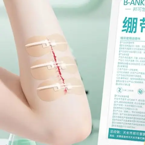 

1 шт., завязка на молнии, пластырь для закрытия ран, кровоостанавливающий пластырь, быстрый шовный пластырь на молнии, портативный уличный пластырь