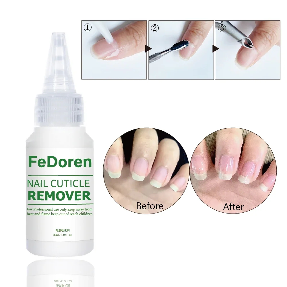 30ML Nail Cuticle Remover ammorbidente liquido per la riparazione delle unghie Gel esfoliante trattamento per cuticole Manicure ammorbidire la pelle morta per la cura delle unghie