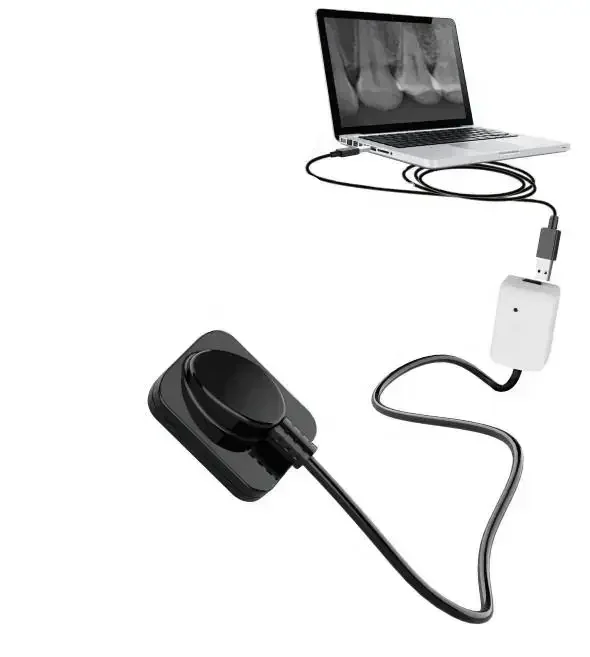 digital oral X-ray sensor oral imaging system dental X-ray sensor R1/R2 with dental hospital Hot sales
