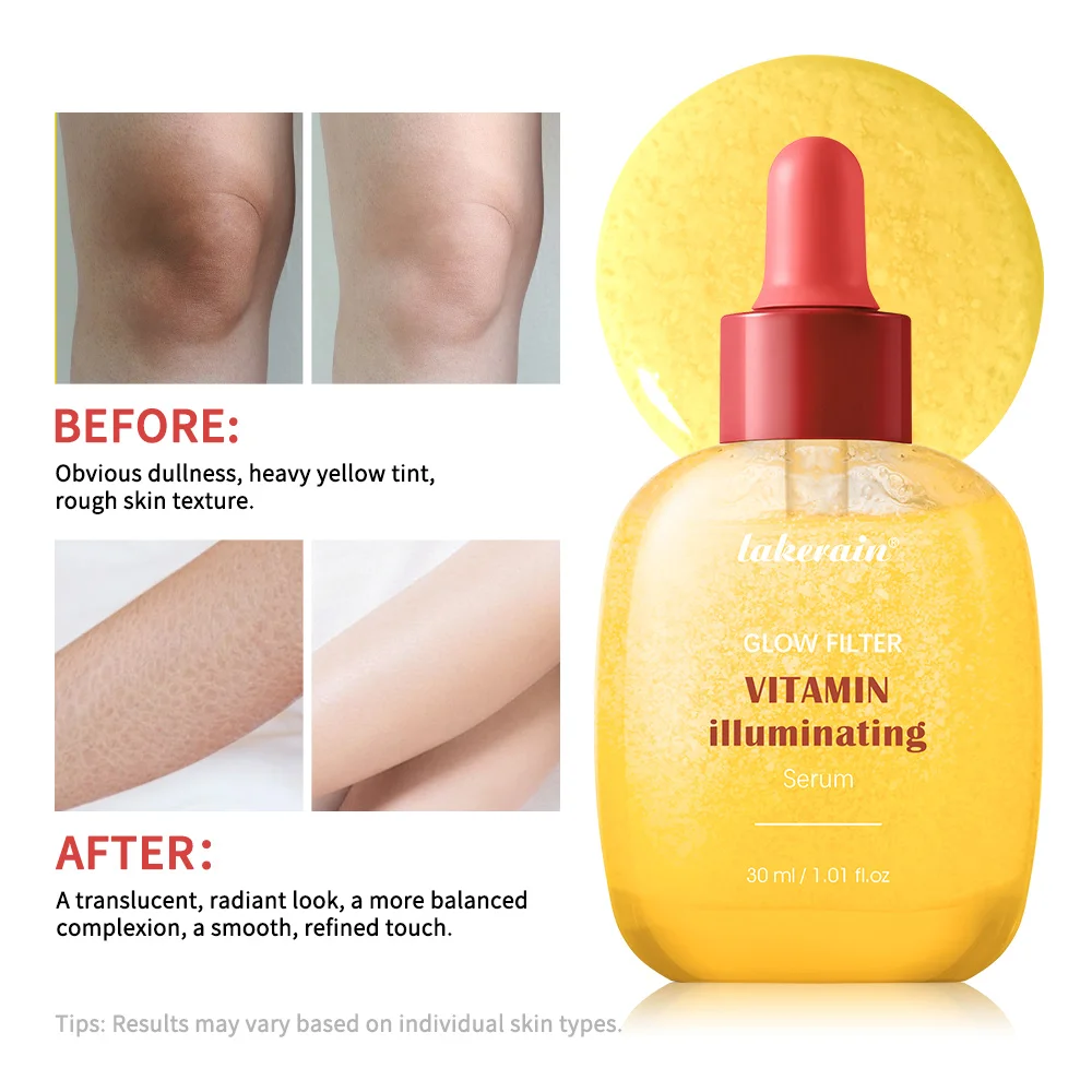 serum-facial-preenchedor-de-30ml-tratamento-de-cuidado-profundo-com-vitamina-iluminador-e-hidratante-para-melhorar-a-firmeza-da-pele