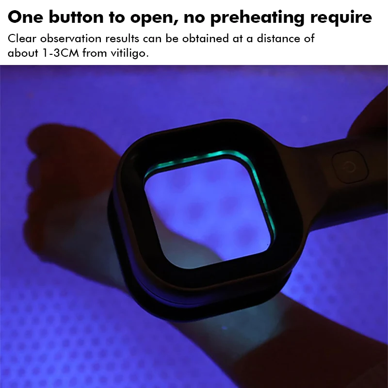 Woods Lamp Skin Analyzer Skin UV 365 Nanometer UV Irradiation Equipment Face Beauty Skin Care for Pet Cat and Dog