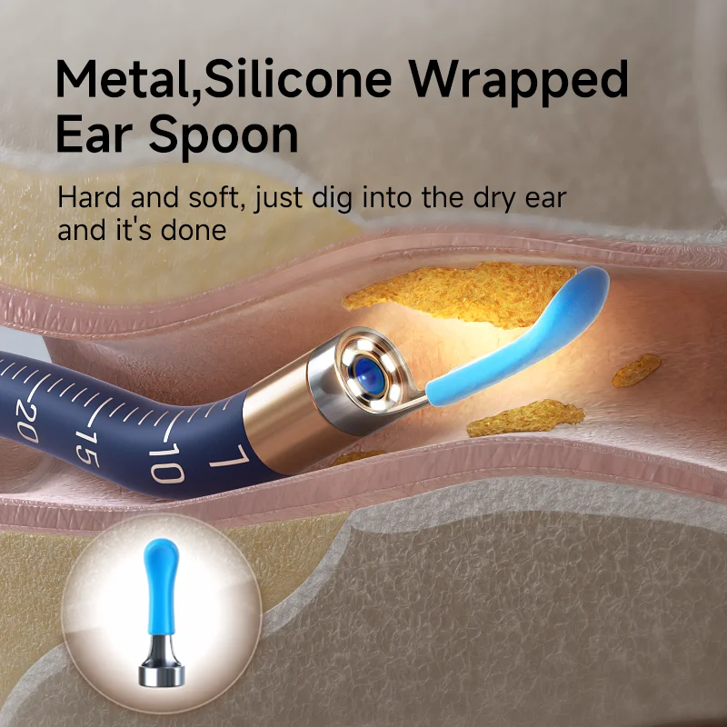 Bebird EarSight Plus Ear Tips Replacement Accessory Set - Image 4