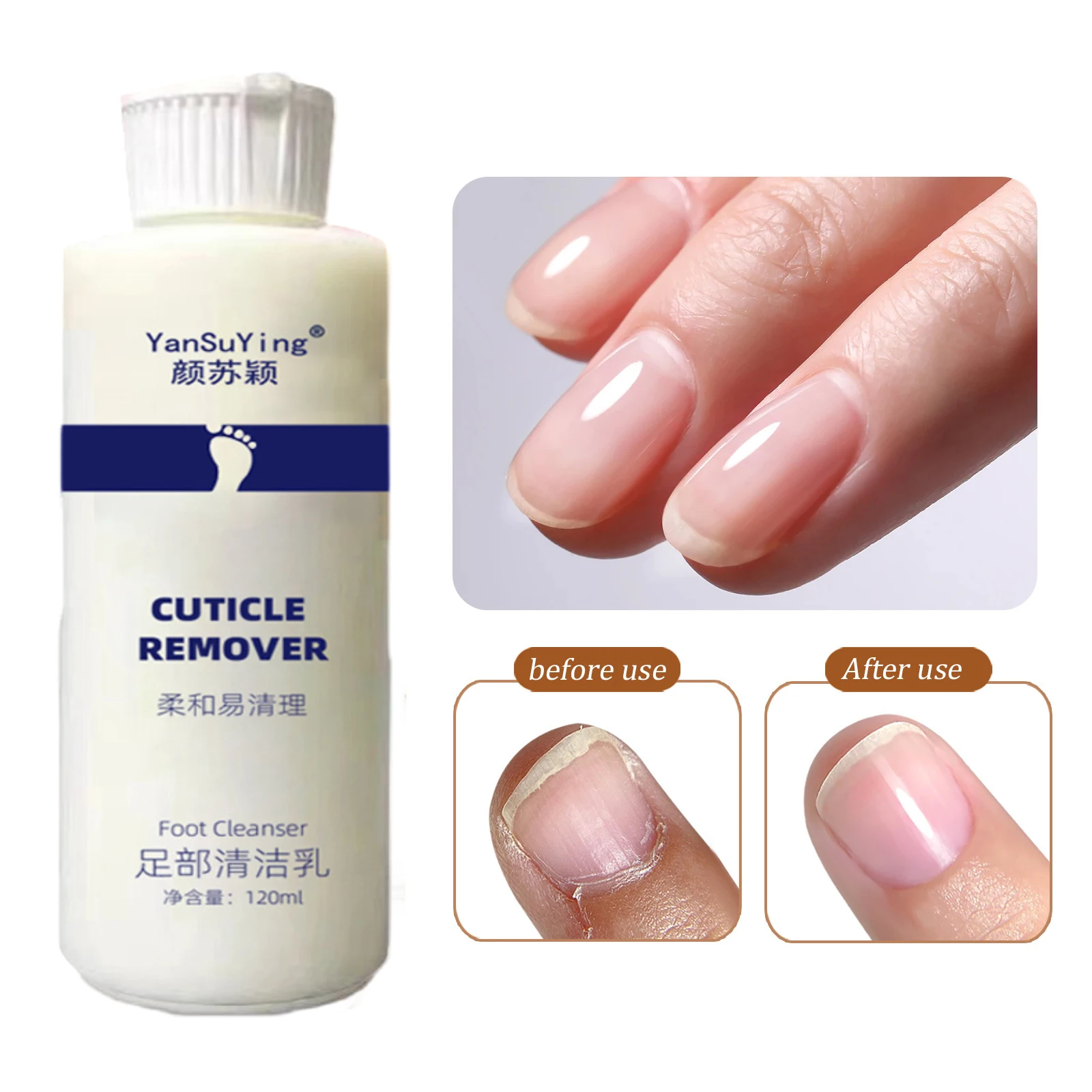 Kit de pédicure anti-fissure pour les ongles, expanseur pour les pieds, adoucissant, 7 secondes, élimination de la fréquence, peau et callosités,