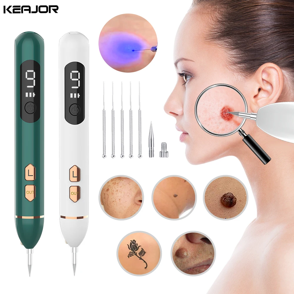 Ponto Preto na Pele: O Que Pode Ser e Como Tratar com o Removente de Ponto Preto a Laser Plasma